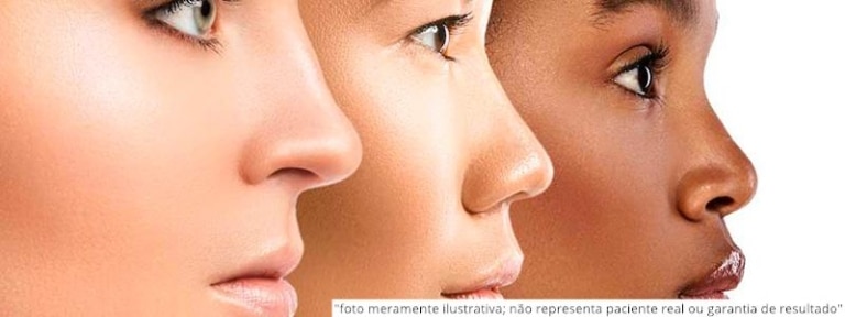 Tipos de nariz: Conheça os tipos de nariz mais comuns
