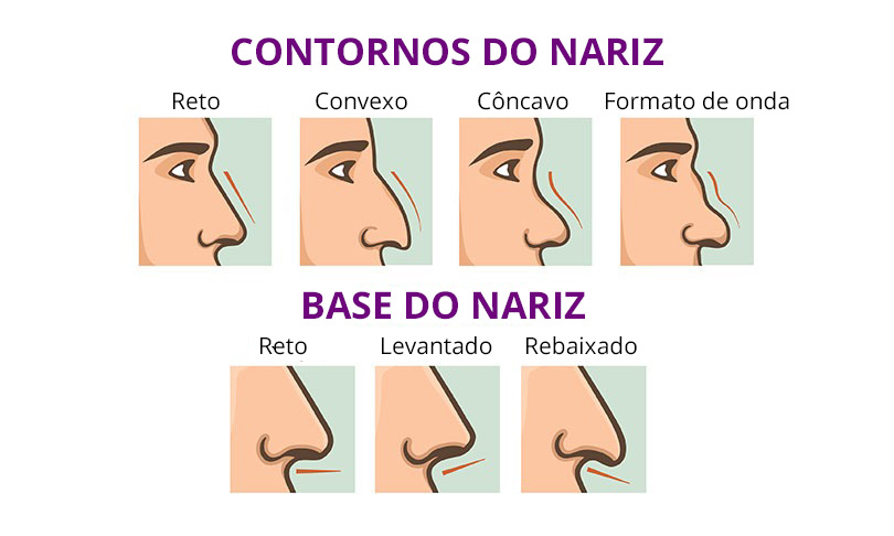 Tipos de nariz: Base e contornos.