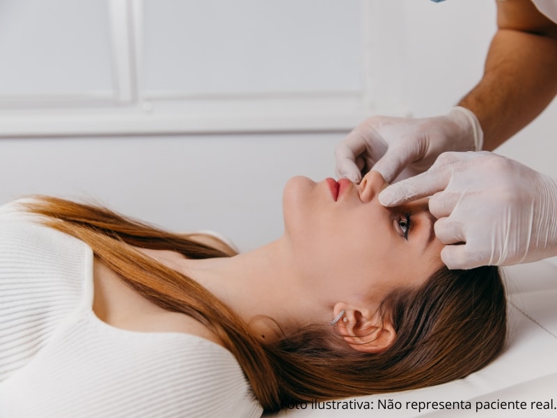 recuperação rinoplastia e técnicas