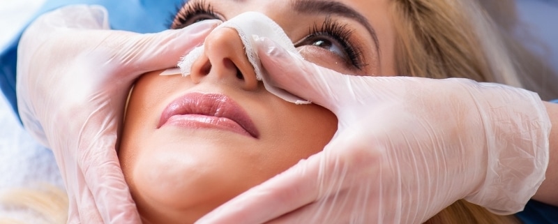 recuperação rinoplastia