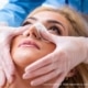 recuperação rinoplastia
