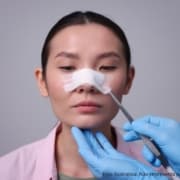 rinoplastia evolução mês a mês