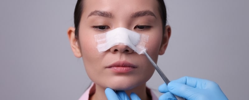 rinoplastia evolução mês a mês