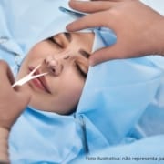 tipos de rinoplastia