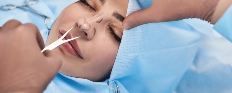 tipos de rinoplastia