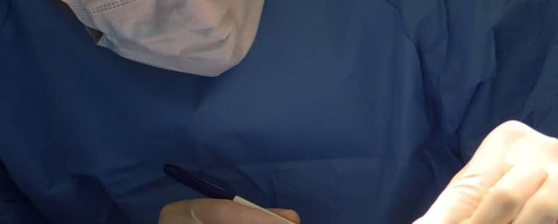 Rinoplastia para Afinar o Nariz