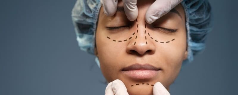 cirurgia para diminuir a asa do nariz