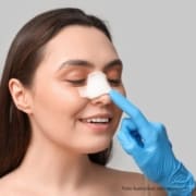 cirurgia para diminuir o nariz de batata