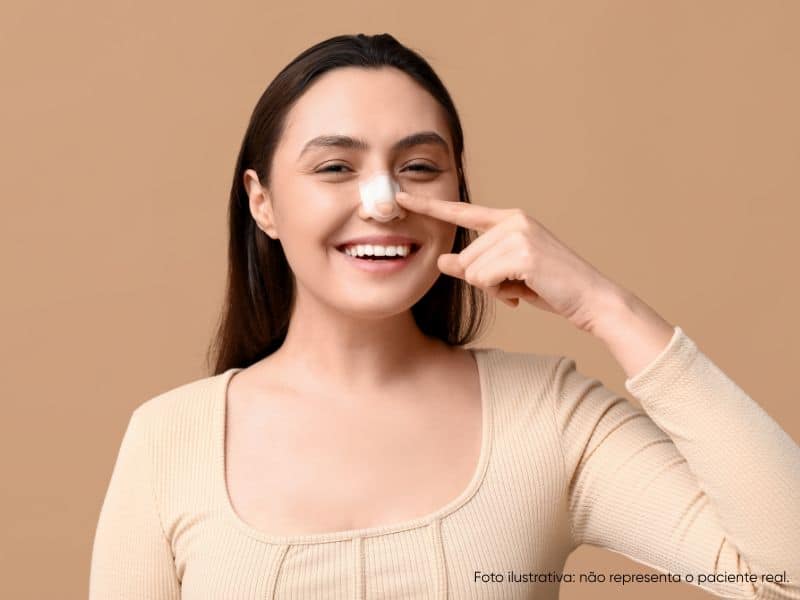 cirurgia para diminuir o nariz de batata confiável