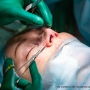 plástica no nariz valor