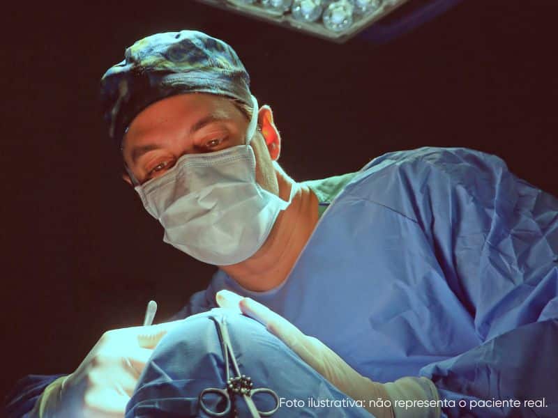 plástica nariz largo como funciona