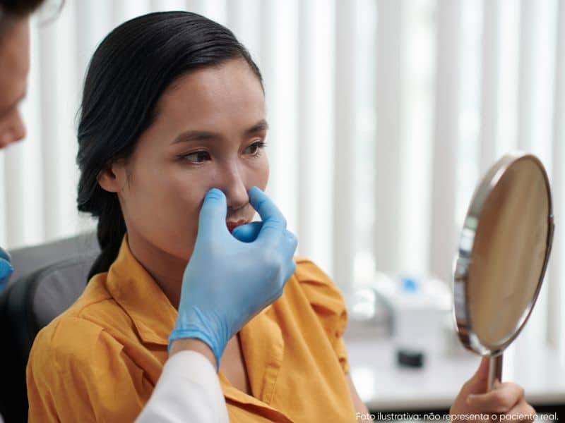 plástica nariz largo quando é indicada