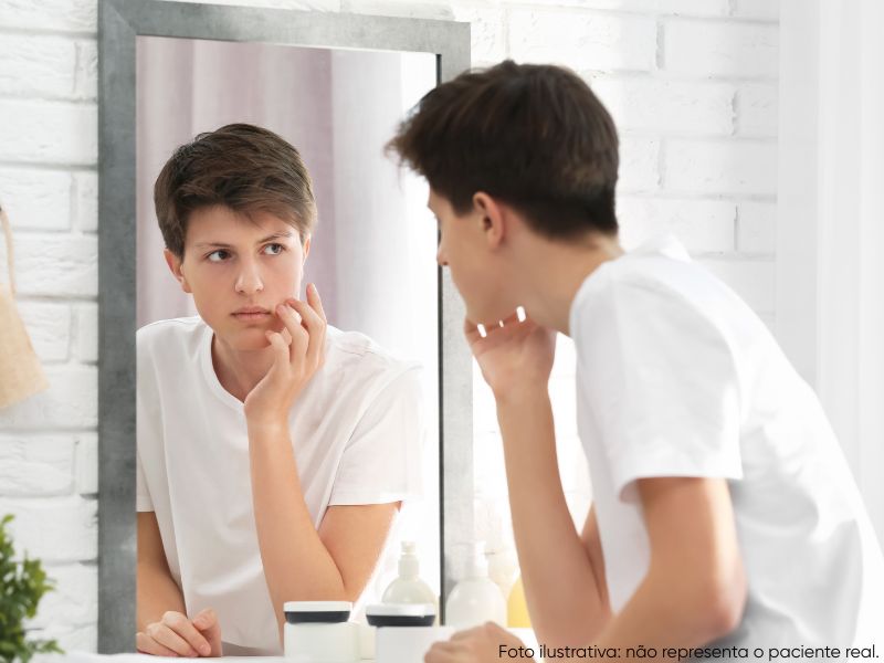 com quantos anos pode fazer rinoplastia masculina com segurança