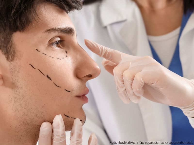 com quantos anos pode fazer rinoplastia masculina sem perigos