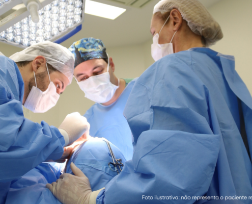 antes e depois rinoplastia secundaria