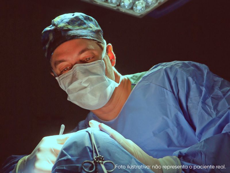 antes e depois rinoplastia secundaria quando é necessária