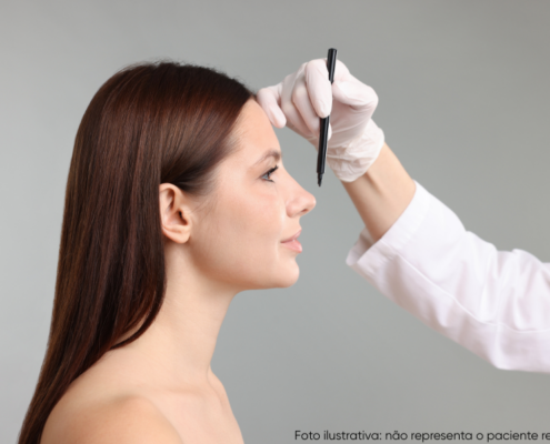 com quantos anos pode fazer rinoplastia feminina