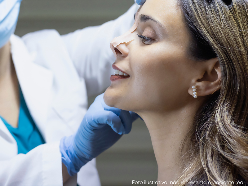 com quantos anos pode fazer rinoplastia feminina com um profissional