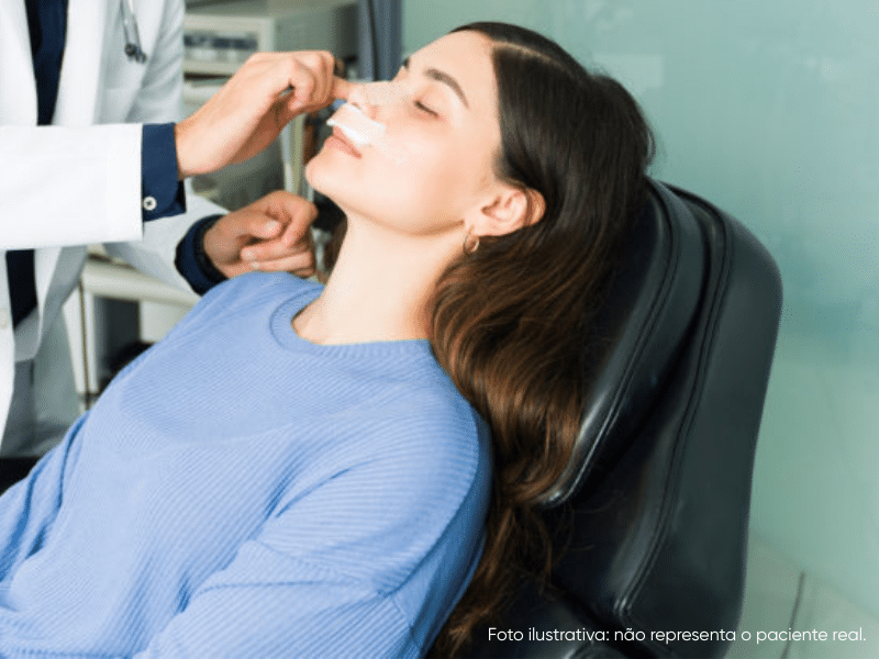 como dormir após rinoplastia secundária