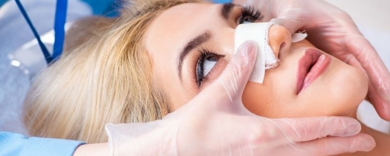 cuidados após rinoplastia secundária