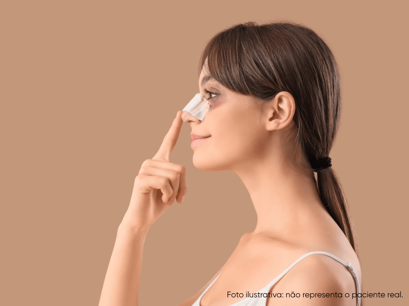 cuidados após rinoplastia secundária cuidados