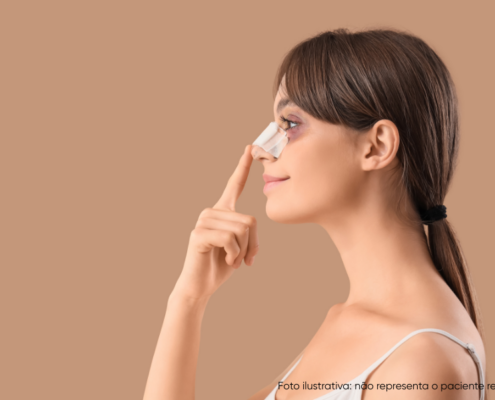 cheiro ruim após rinoplastia