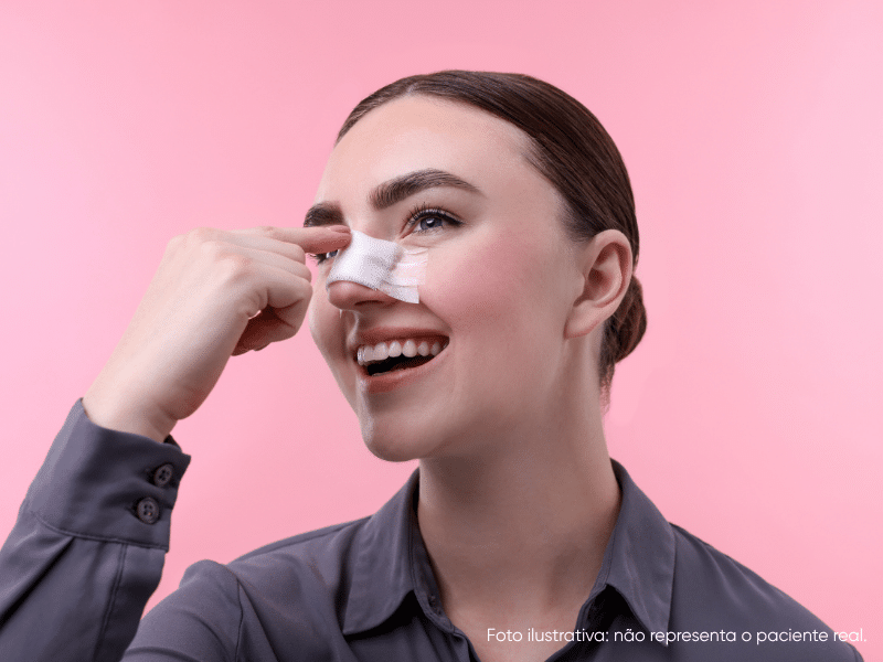 rinoplastia pele grossa antes e depois como proceder