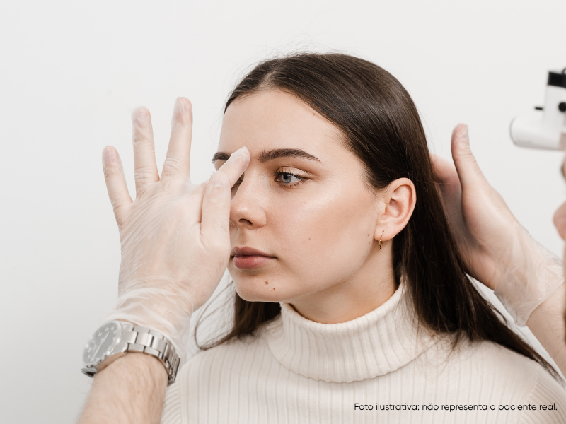 calo ósseo após rinoplastia quando aparece