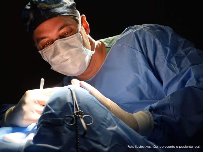rinoplastia perfeita estruturada