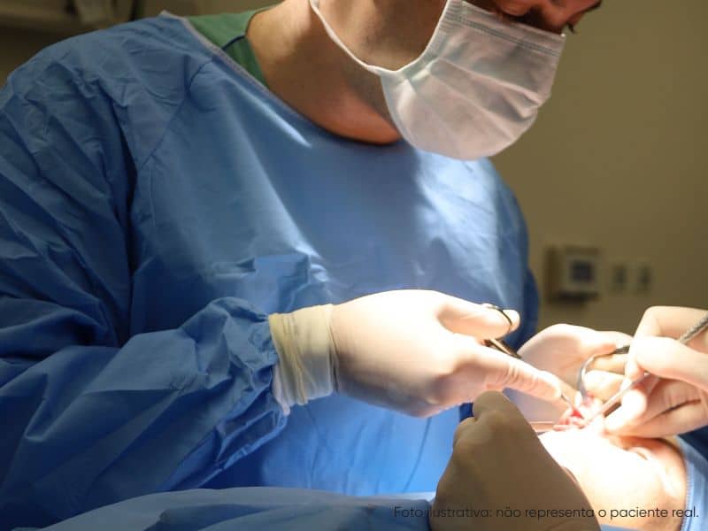 rinoplastia perfeitas secundária