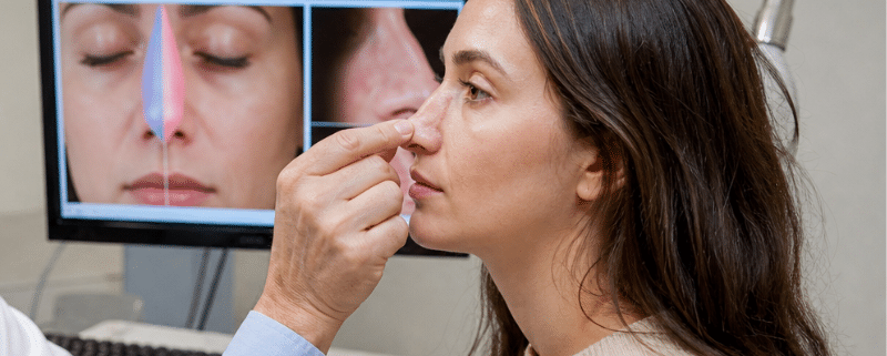Quanto custa uma rinoplastia em São Paulo